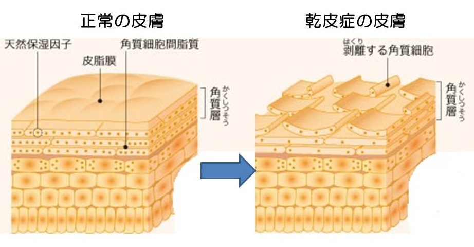 今日の診察室から「肌がカサカサしてかゆくなります」（60歳代